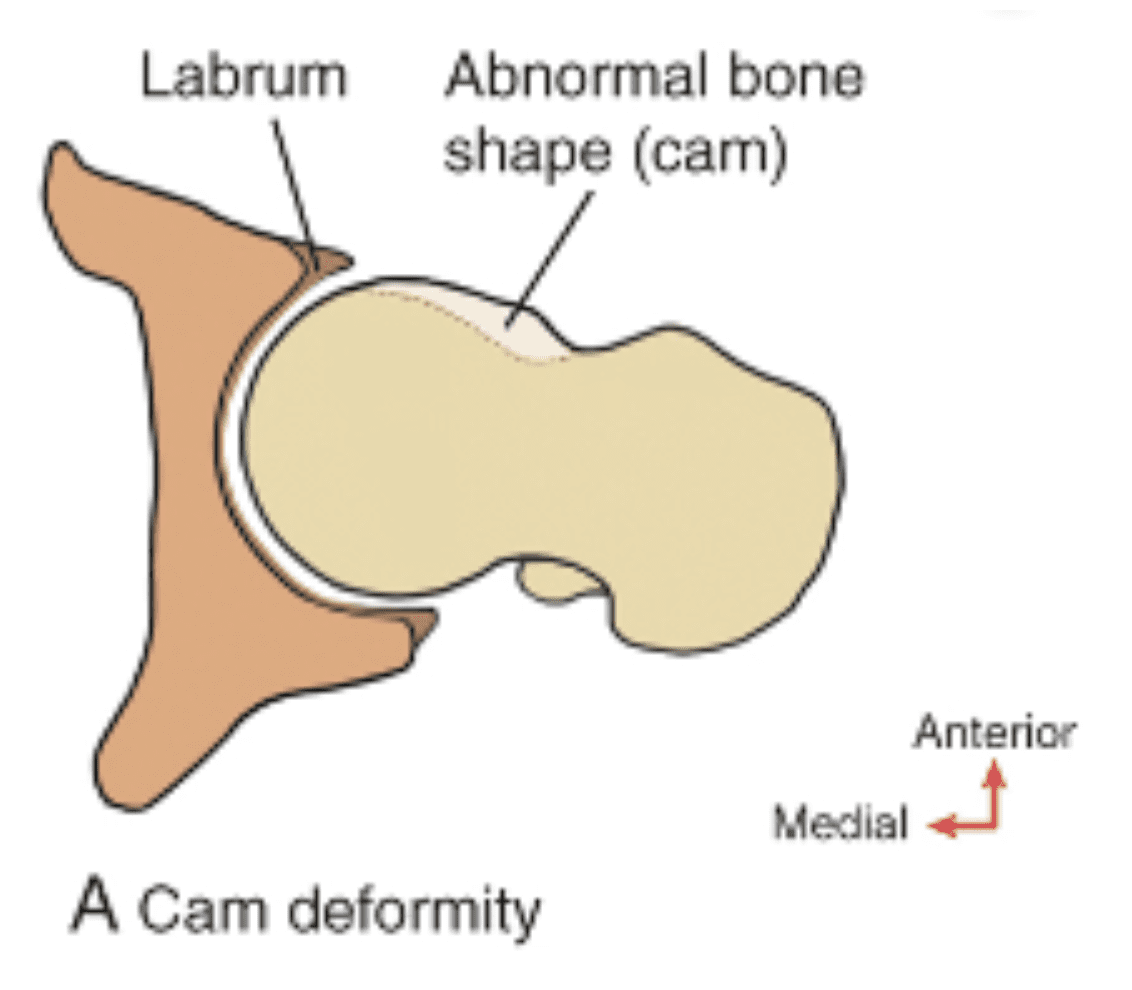 Hip and Groin pain Advanced Clinical Education Educating, mentoring