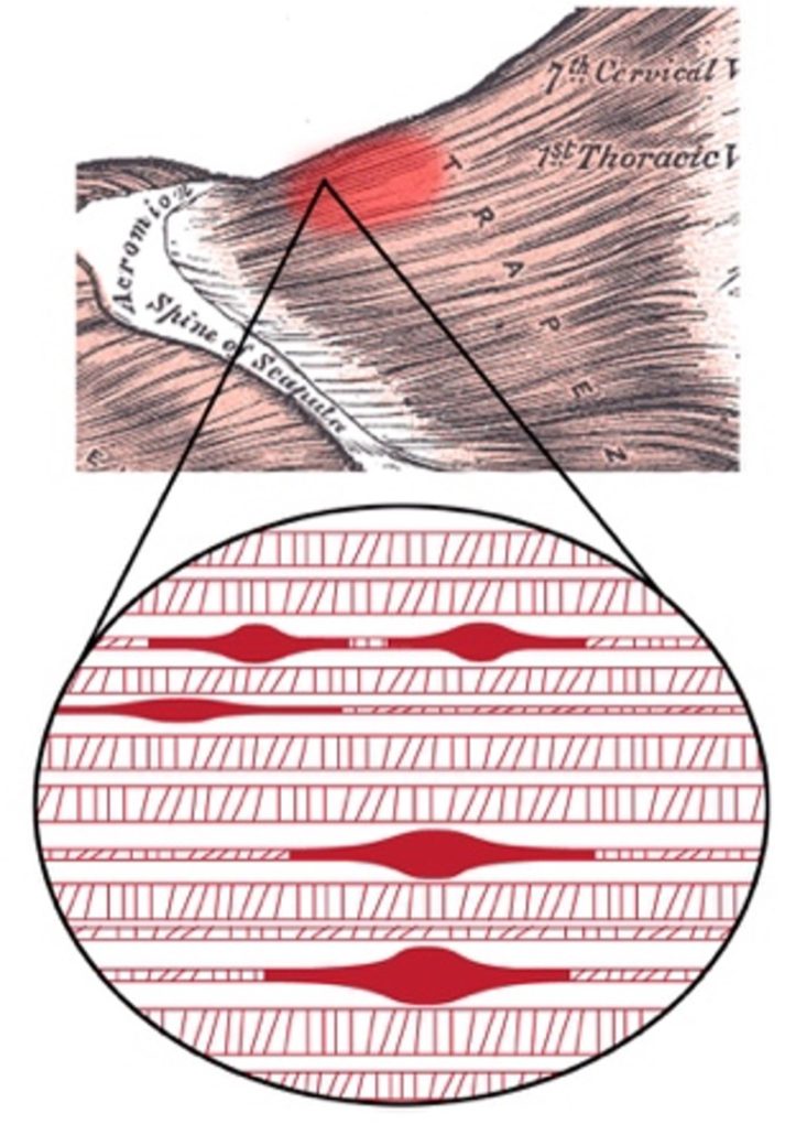 Palpation photo